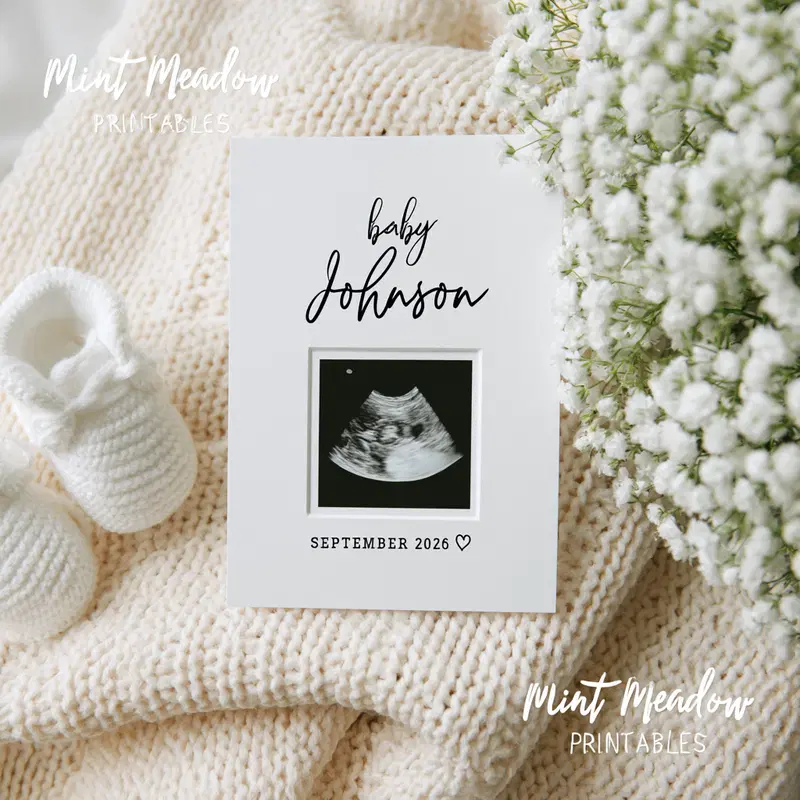Baby ultrasound art print with delicate knitted baby booties and flowers