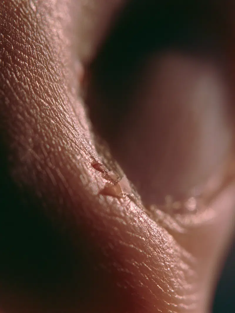 Extreme close-up macro image of peeling dry skin near fingernail
