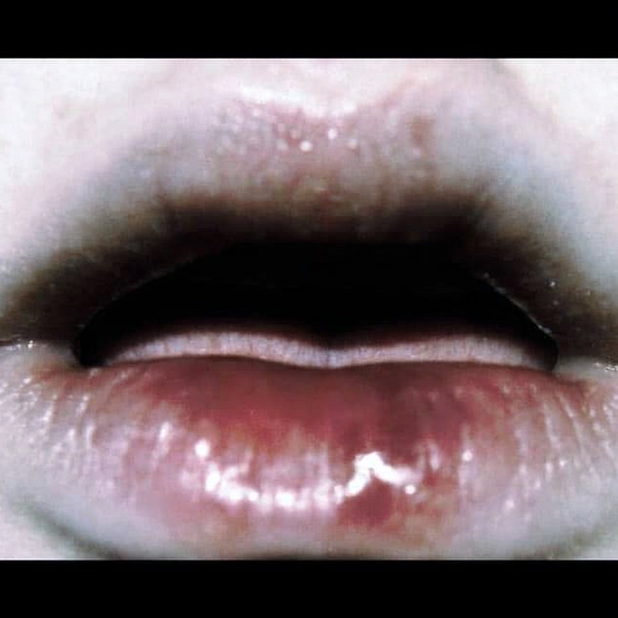 Close-up image of human lips slightly parted, showing glossy, wet texture with visible skin details and shading